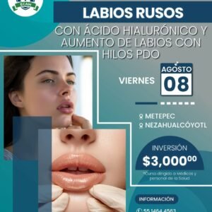 labios rusos con Ácido hialurónico y aumento de labios con hilos pdo