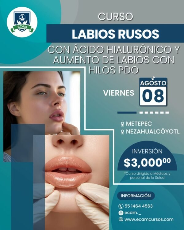 labios rusos con Ácido hialurónico y aumento de labios con hilos pdo